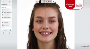 Colgate-Palmolive’s Colgate Illuminator Is Predictive Tool for Tooth Whitening Treatment