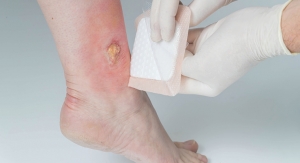 Silicone Advances Open Doors for New Wound Care and Wearables Development