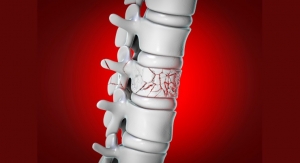 Vertebral Compression Fracture Devices Market to Approach $2B by 2030