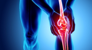 A Look at Knee Implants Beyond the Market Leaders