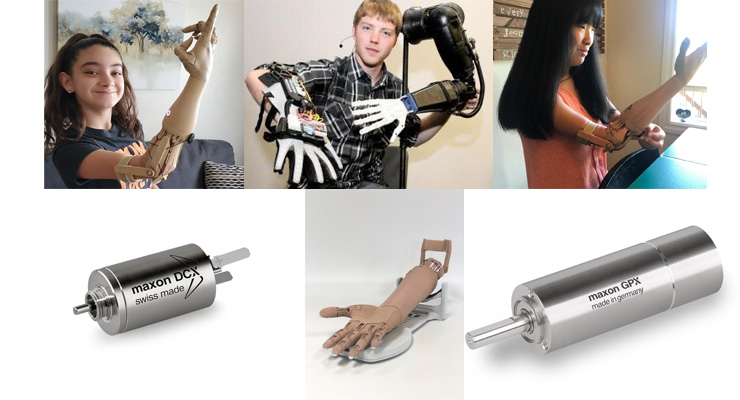 Personalized Prosthetics empowers amputees