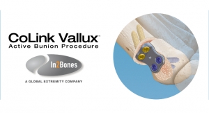 In2Bones Releases CoLink Vallux Active Bunion Procedure
