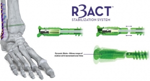 Paragon 28 Rolls Out R3ACT Stabilization for Ankle Injuries