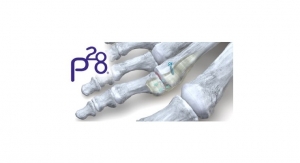 Paragon 28 Launches Paratrooper Plantar Plate System