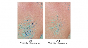 Silab’s Active Ingredient Adaptonyl Refines Skin Grain, Revives Complexion Radiance
