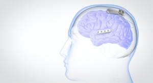 First Patient Treated in NeuroPace’s RESPONSE Clinical Trial