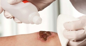 The Role of Wound Cleansers in Wound Management