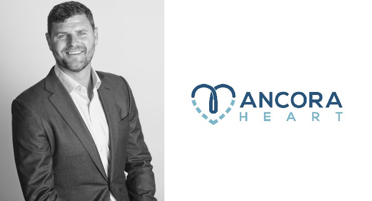 Mark Miles Appointed Chief Commercial Officer at Ancora Heart
