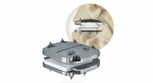 Centinel Spine Completes First prodisc C Vivo Cervical Total Disc Replacement Surgery