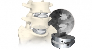 NASS News: Centinel Spine to Feature Long-Term prodisc L Study