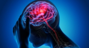 Theranica Shares Results from Clinical Trial Evaluating Nerivio for Treatment of Migraines