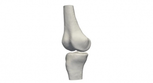 Clinical Study of 2D-to-3D Knee Bone Reconstruction Yields Positive Results