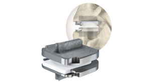 Centinel Spine Marks First Commercial Use of prodisc C SK Cervical Total Disc Replacement