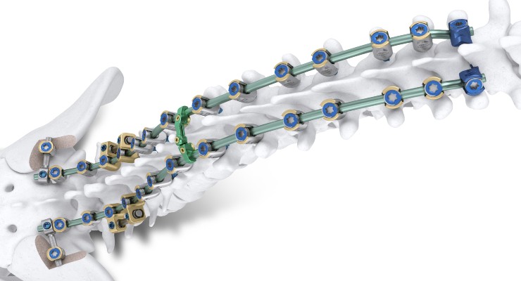 Orthofix Launches the Mariner Deformity System