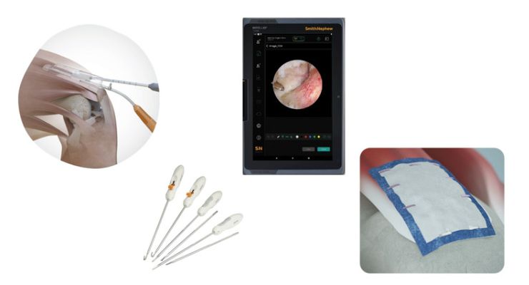 AAOS News: Smith+Nephew Highlights Sports Med Procedural Innovations