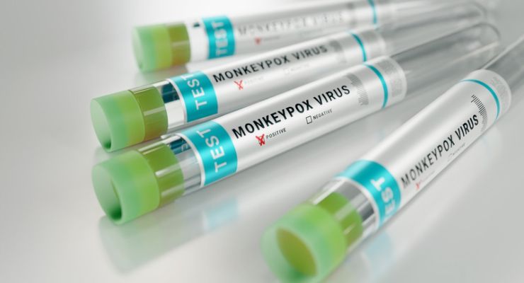 Cue Health Nabs EUA for Molecular Mpox Test