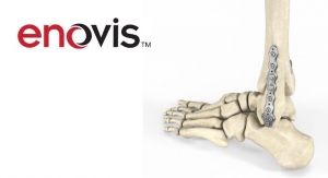 Enovis Rolls Out Knotless Syndesmotic Repair System