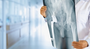Hip Innovation Technology Begins IDE Study of its Reverse Hip Replacement System