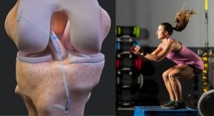 Arthrex Launches New Patient-Focused Website for ACL Injuries