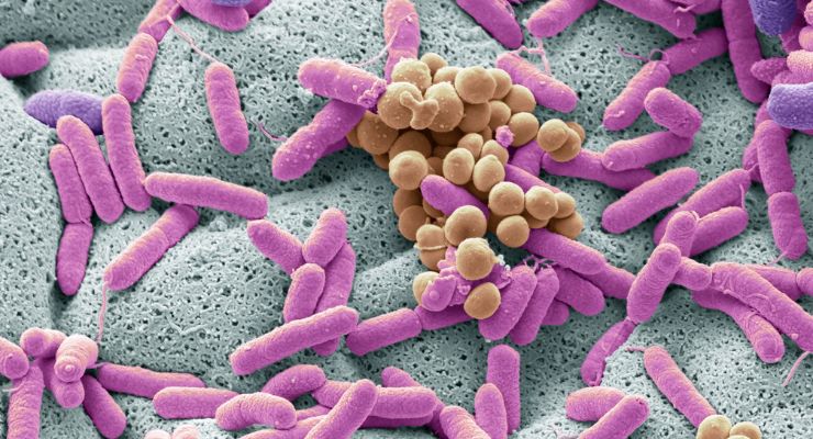 Probiotic Strain May Reduce Listeria Infections: Animal Study 